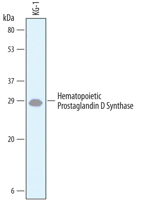 Detection of Human Hematopoietic Prostaglandin D Synthase/HPGDS antibody by Western Blot.