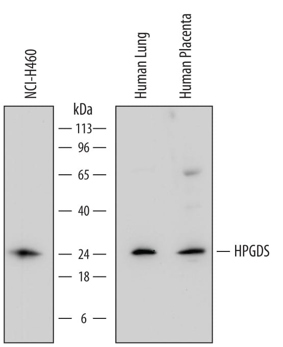 Detection of Human Hematopoietic Prostaglandin D Synthase/HPGDS antibody by Western Blot.