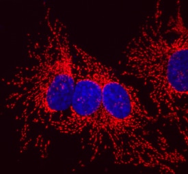 HSP10/EPF antibody in HeLa Human Cell Line by Immunocytochemistry (ICC).
