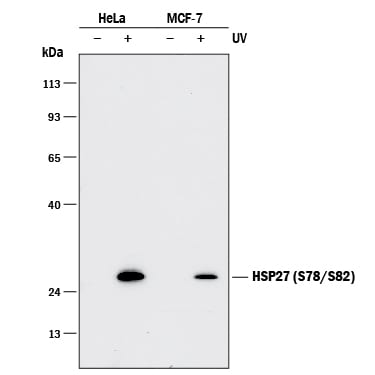 Detection of Phospho-Human HSP27 (S78/S82) antibody by Western Blot.