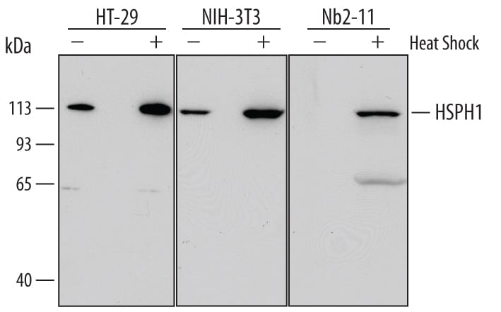 Detection of Human, Mouse, and Rat HSPH1 antibody by Western Blot.