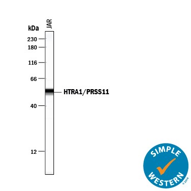 Detection of Human HTRA1/PRSS11 antibody by Simple WesternTM.