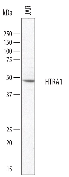 Detection of Human HTRA1/PRSS11 antibody by Western Blot.