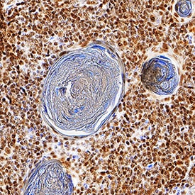 Helios antibody in Human Thymus by Immunohistochemistry (IHC-P).