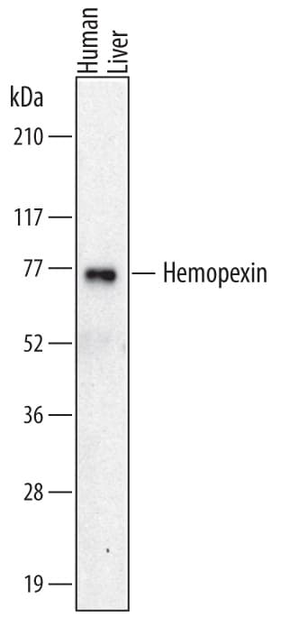 Detection of Human Hemopexin antibody by Western Blot.