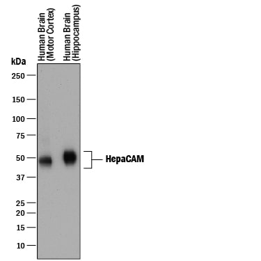 Detection of Human HepaCAM antibody by Western Blot.