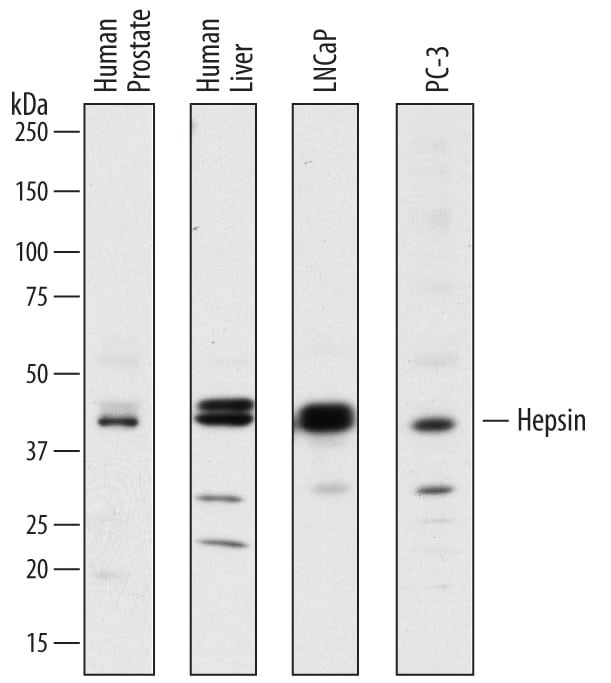 Detection of Human Hepsin antibody by Western Blot.