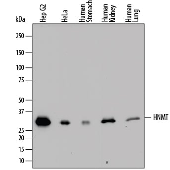Detection of Human Histamine N-Methyltransferase/HNMT antibody by Western Blot.