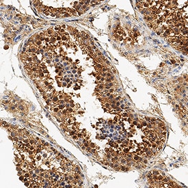 Histone Deacetylase 4/HDAC4 antibody in Human Testis by Immunohistochemistry (IHC-P).