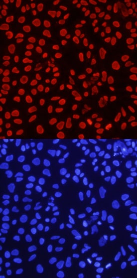 Histone H4 antibody in NTera-2 Human Cell Line by Immunocytochemistry (ICC).