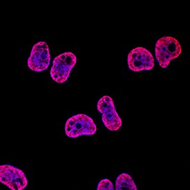 Acetyl Histone H4 (Lys5) antibody in HeLa Human Cell Line by Immunocytochemistry (ICC).