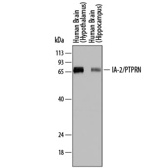 Detection of Human IA-2/PTPRN antibody by Western Blot.