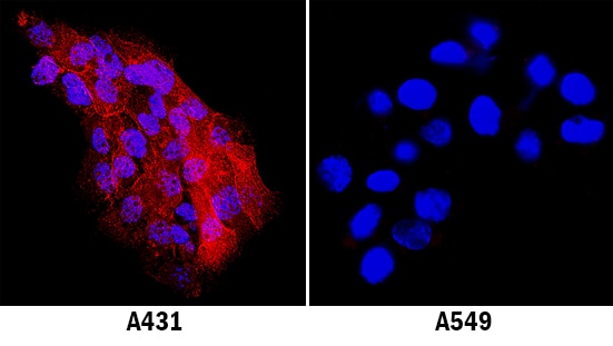 ICAM‑1/CD54 antibody in A431 Human Cell Line by Immunocytochemistry (ICC).