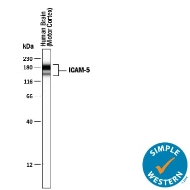 Detection of Human ICAM-5 antibody by Simple WesternTM.