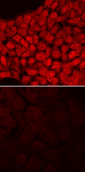 ID1 antibody in BG01V Human Embryonic Stem Cells by Immunocytochemistry (ICC).