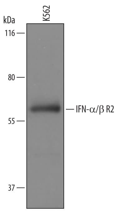 Detection of Human IFN-a/ beta  R2 antibody by Western Blot.