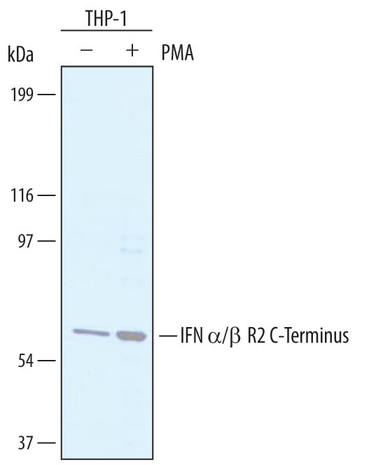 Detection of Human IFN-a/ beta  R2 antibody by Western Blot.