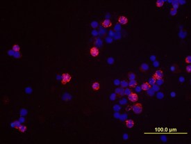 IFN‑? antibody in Human PBMCs by Immunocytochemistry (ICC).