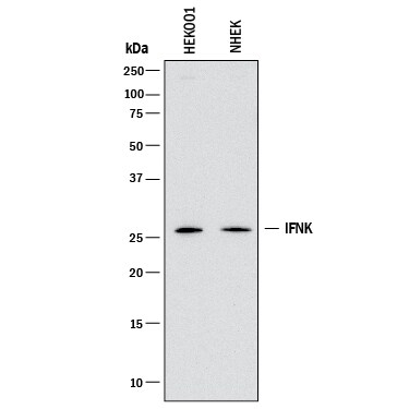 Detection of Human IFN-alpha 6/IFNA6 antibody by Western Blot.