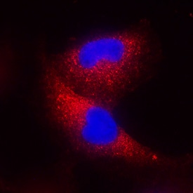 IFN-beta  antibody in A549 Human Cell Line by Immunocytochemistry (ICC).