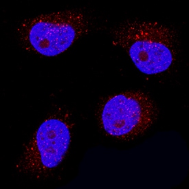 IFN-epsilon antibody in HeLa Human Cell Line by Immunocytochemistry (ICC).