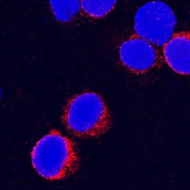 IFN-? antibody in Bovine PBMCs by Immunocytochemistry (ICC).