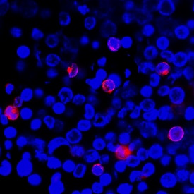 IFN-? antibody in Human PBMCs by Immunocytochemistry (ICC).
