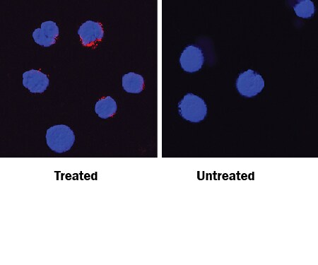 IFN-? antibody in Mouse Splenocytes by Immunocytochemistry (ICC).