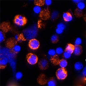 IFN-? antibody in Feline PBMCs by Immunocytochemistry (ICC).