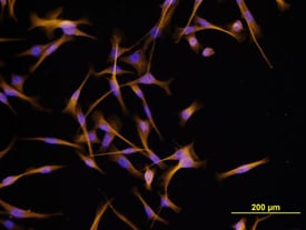 IGF-I/IGF-1 antibody in MDA-MB-231 Human Cell Line by Immunocytochemistry (ICC).