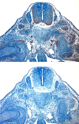 IGF-I/IGF-1 antibody in Mouse Embryo by Immunohistochemistry (IHC-Fr).