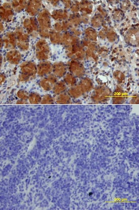 IGFBP-4 antibody in Human Stomach by Immunohistochemistry (IHC-P).