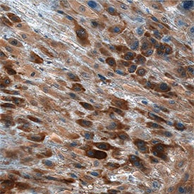 IGF-I/IGF-1 antibody in Human Placenta by Immunohistochemistry (IHC-P).