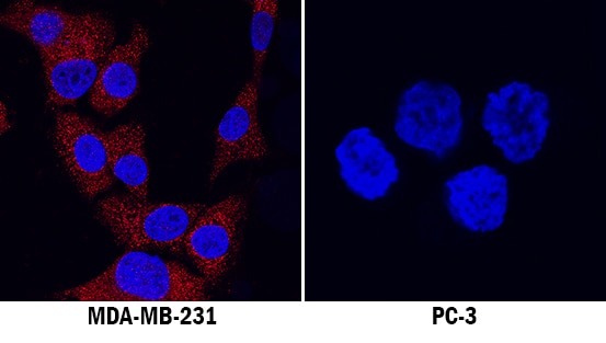 IGF-I/IGF-1 antibody in MDA-MB-231 and PC-3 Human Cell Lines by Immunocytochemistry (ICC).