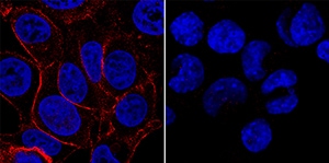 IGF-I R/IGF1R antibody in MCF-7 and HDLM-2 Human Cell Lines by Immunocytochemistry (ICC).
