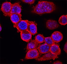 IGSF8/CD316 antibody in Neuro-2A Mouse Cell Line by Immunocytochemistry (ICC).