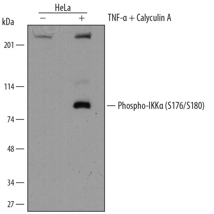 Detection of Human Phospho-IKKa (S176/S180) antibody by Western Blot.