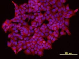 IKKe antibody in MCF-7 Human Cell Line by Immunocytochemistry (ICC).
