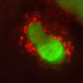 IL‑10 Ra antibody in Human PBMCs by Immunocytochemistry (ICC).