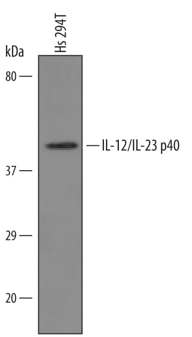 Detection of Human IL-12/IL-23 p40 antibody by Western Blot.