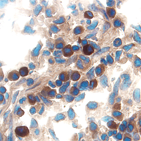 IL‑15 antibody in Mouse Intestine by Immunohistochemistry (IHC-Fr).