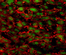 IL‑17 RD/SEF antibody in Mouse Liver by Immunohistochemistry (IHC-Fr).