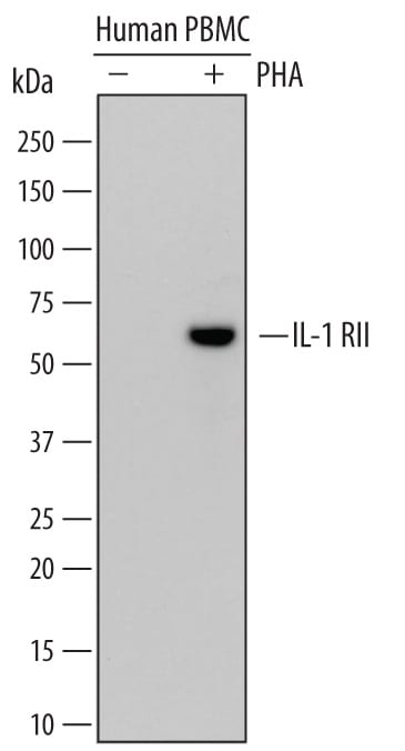 Detection of Human IL‑1 RII antibody by Western Blot.