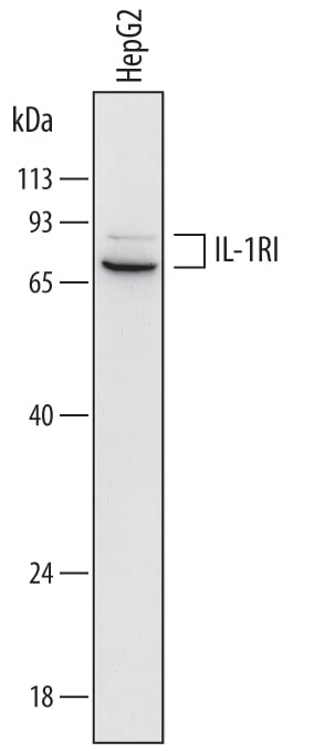 Detection of Human IL-1 RI antibody by Western Blot.