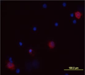 IL-1a/IL-1F1 antibody in Human PBMCs by Immunocytochemistry (ICC).