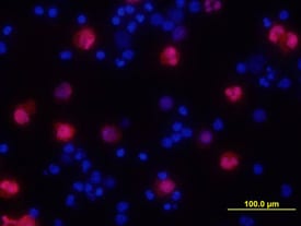 IL-1a/IL-1F1 antibody in Human PBMCs by Immunocytochemistry (ICC).