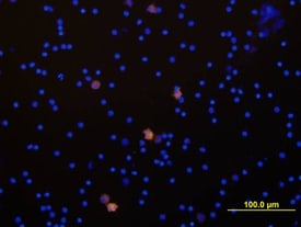 IL-1a/IL-1F1 antibody in Human PBMCs by Immunocytochemistry (ICC).