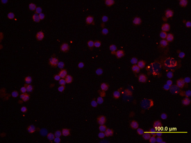 IL‑1a/IL‑1F1 antibody in Human PBMCs by Immunocytochemistry (ICC).