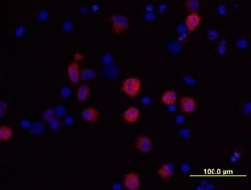 IL-1 beta /IL-1F2 antibody in Human PBMCs by Immunocytochemistry (ICC).