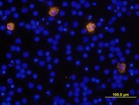IL-1 beta /IL-1F2 antibody in Human PBMCs by Immunocytochemistry (ICC).